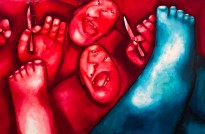 Олег Целков — Операция, 2018 (холст, масло)